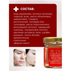 Мазь при псориазе, экземе, грибке, дерматите «Святая Рука», 30 мл