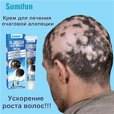 Крем от алопеции, активатор роста волос SUMIFUN