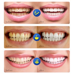 Зубная паста для удаления налета от сигарет Sadoer Smokes Stains, 100 гр.