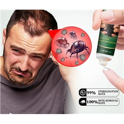 Sumifun MITE Removal cream Крем от клещей, вшей 30гр