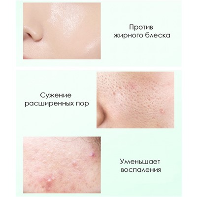 Ночная матирующая гелевая маска с салициловой кислотой и центеллой Bioaqua, 120 мл.