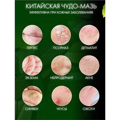 Чудо мазь