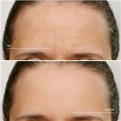 Гидролат Олибанум