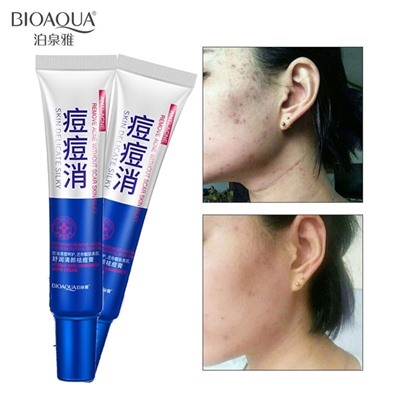 Крем от прыщей Bioaqua Htdian Skin Consumes AcneКосметика уходовая для лица и тела от ведущих мировых производителей по оптовым ценам в интернет магазине ooptom.ru.