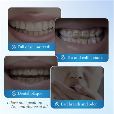 Набор зубных паст ассорти 5 вкусов Sadoer WHITЕ, 5 шт. * 30 гр.