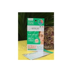 Лечебный пластырь для точечного лечения акне от Skynlab, Acne Patch 1 шт (10 пластырей)