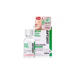 Средство для лечения прыщей и акне OXECURE Acne Clear Potion 15 мл