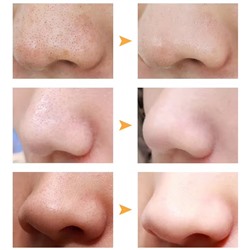 Очищающие полоски для носа, Набор 10 штук.