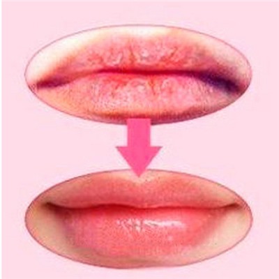 Маска для губ Life Hospital с коллагеном Косметика уходовая для лица и тела от ведущих мировых производителей по оптовым ценам в интернет магазине ooptom.ru.