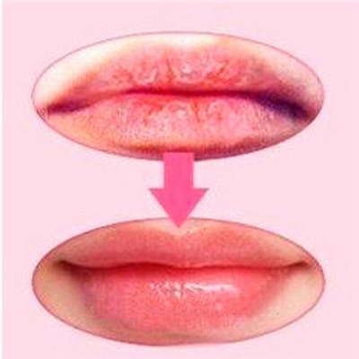 Маска для губ Life Hospital с коллагеном Косметика уходовая для лица и тела от ведущих мировых производителей по оптовым ценам в интернет магазине ooptom.ru.