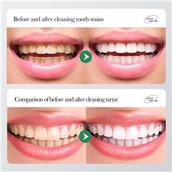 (ЗАМЯТА КОРОБОЧКА) Зубная паста с содой и кальцием BIOAQUA Baking Soda Toothpaste, 100 гр.