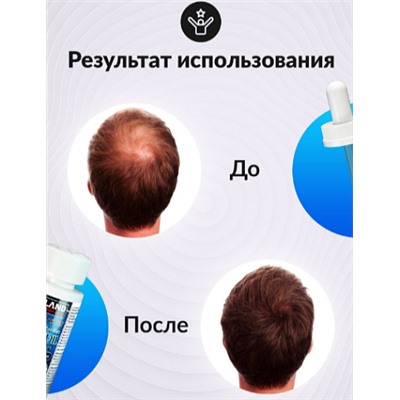 УЦЕНКА "Minoxidil Kirkland 5%" - средство для роста волос и бороды, 60 мл