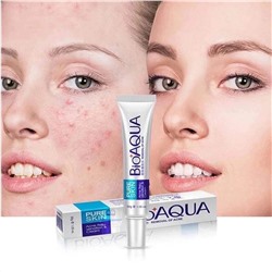 КРЕМ ОТ ПРЫЩЕЙ Pure Skin Removal of Acne Cream, код 50114197